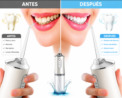 🔥 IRRIGADOR DENTAL PRO: LIMPIEZA PROFUNDA Y SONRISA